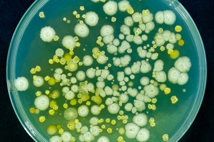 bacteria colonies of different shapes in yellow and white growing on a petri dish