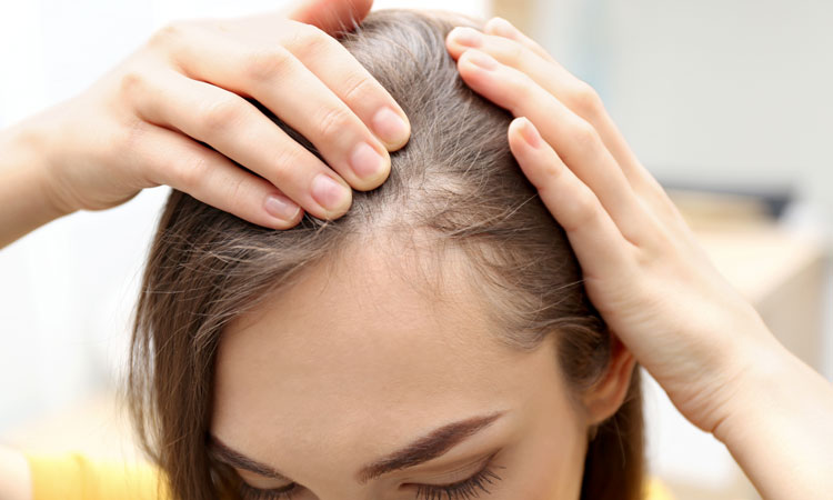Eli Lilly shares impressive hair regrowth results with Olumiant® for  alopecia