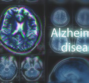 Alzheimer's disease vaccine