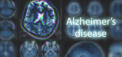 Alzheimer's disease vaccine
