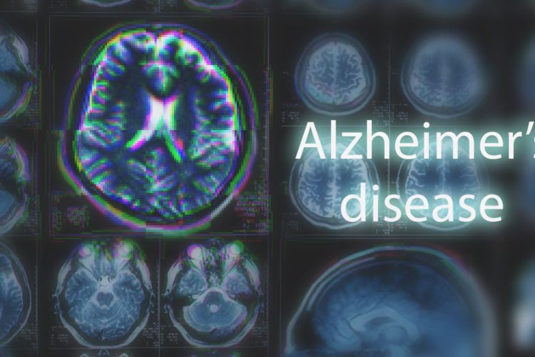 Alzheimer's disease vaccine