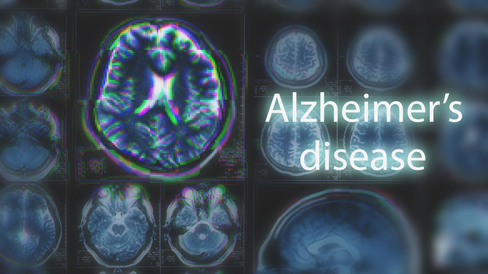 Alzheimer's disease vaccine