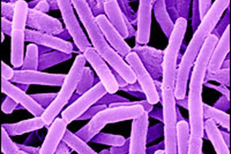 A microscopic look at anthrax bacteria.