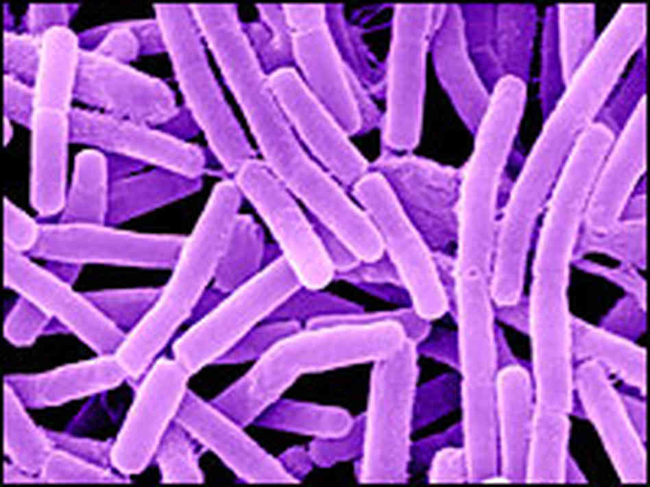 A microscopic look at anthrax bacteria.