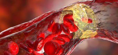 First adult anti-inflammatory cardiovascular drug approved
