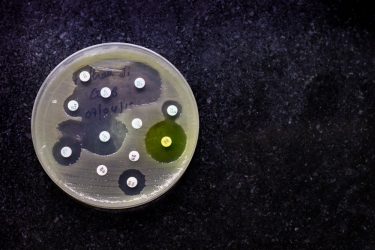 Antimicrobial resistance test with bacterial colonies growing on a petri dish with empty spaces around antibiotic containing discs