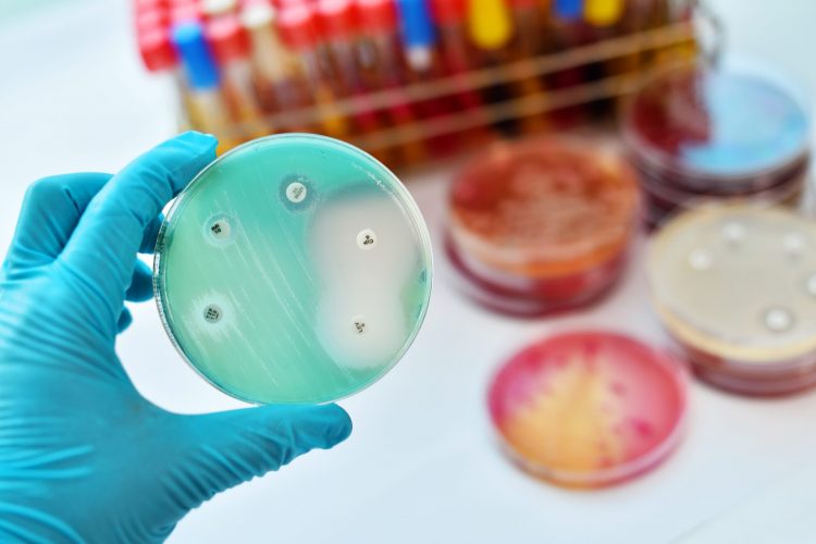 Plate testing antimicrobial susceptability to antibiotics.