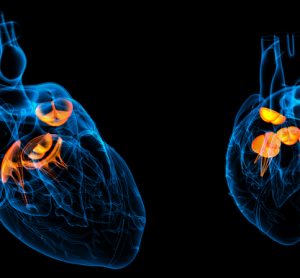 imaging aortic