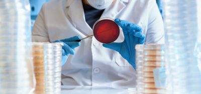 Scientist working with bacteria cultures on petri dishes in labatory