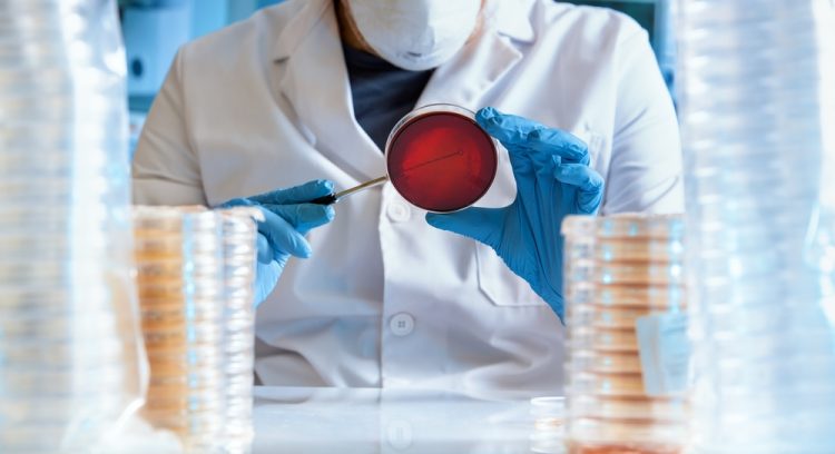 Scientist working with bacteria cultures on petri dishes in labatory