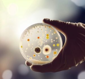 Close up of bacterial colonies on a petri dish - idea of bacterial identification or environmental monitoring