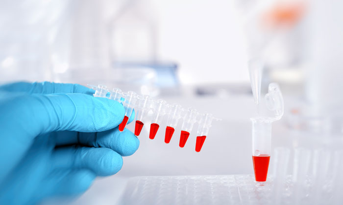 Test tubes for biomarkers