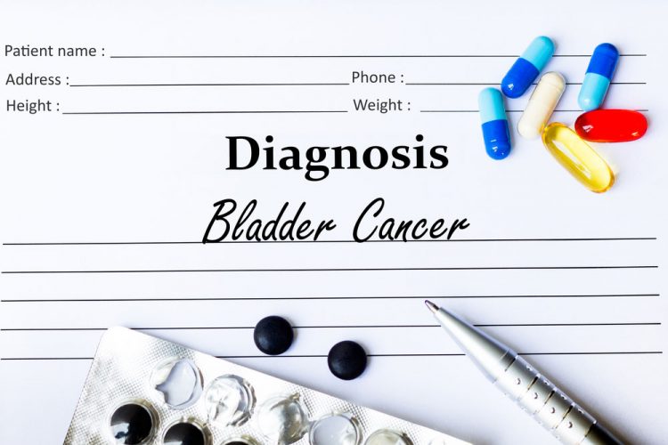 bladder cancer