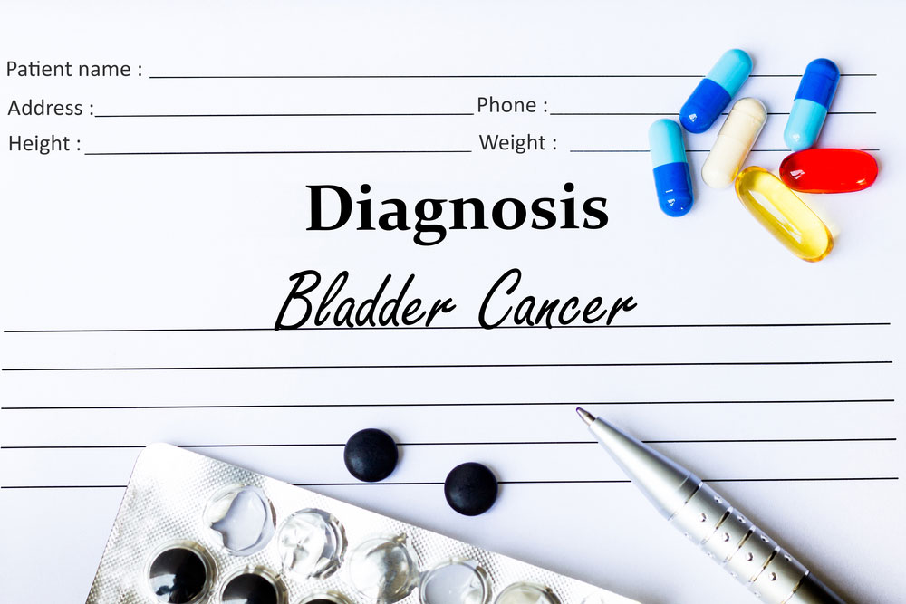 bladder cancer