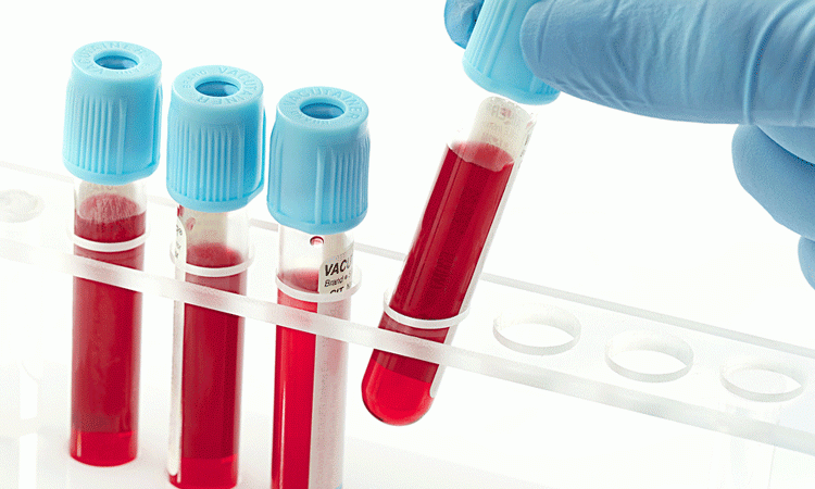 blood test