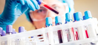 Close up of scientist holding a rack of blood samples
