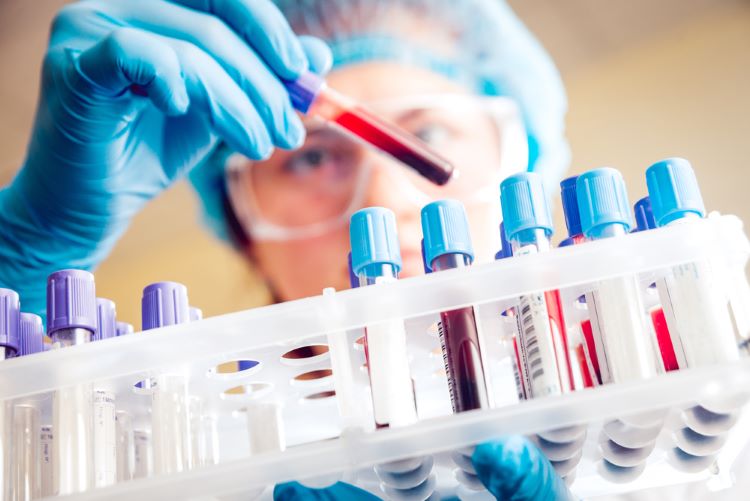 Close up of scientist holding a rack of blood samples