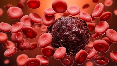 Imetelstat is a telomerase inhibitor that can treat blood cancer