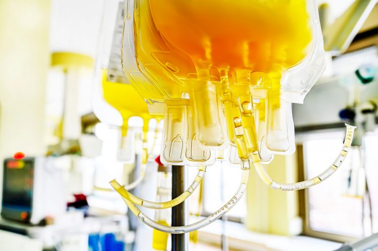 bags of blood plasma hanging for infusion