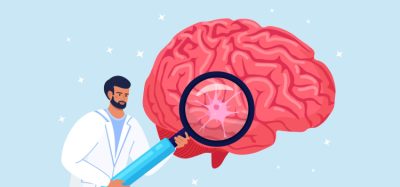 Illustration of scientist holding magnifying glass up to brain