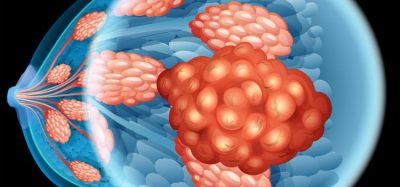 Will ESR1-mutated breast cancer treatment gain approval? CHMP positive opinion