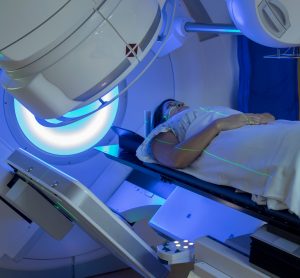 woman receiving external beam radiotherapy