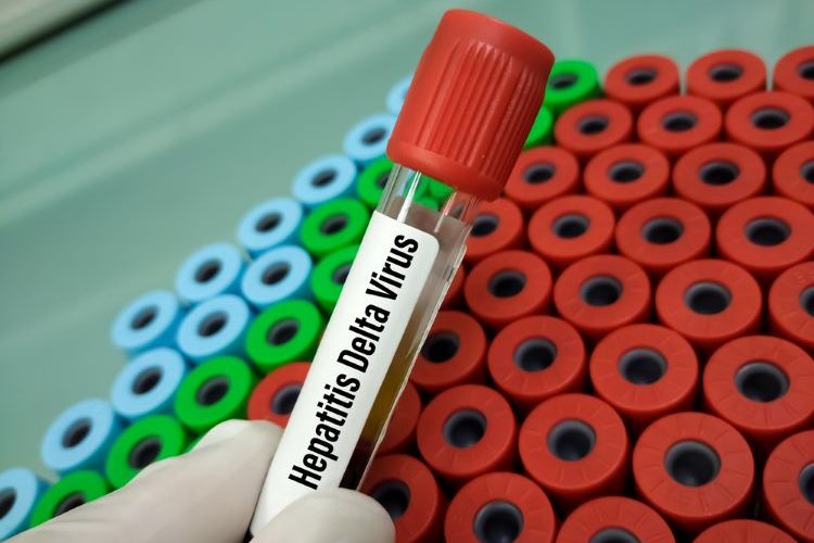 SMC accepts bulevirtide treatment for chronic hepatitis delta virus