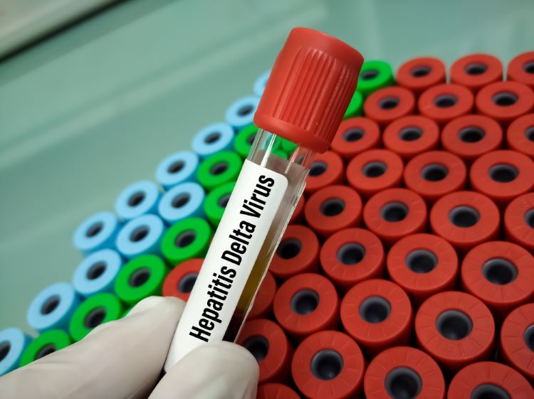 SMC accepts bulevirtide treatment for chronic hepatitis delta virus