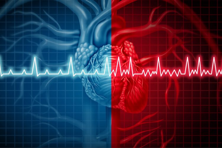 two heart rythms - one over red is arrythmic, the other on blue is normal