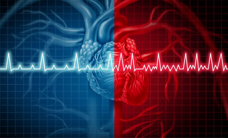 two heart rythms - one over red is arrythmic, the other on blue is normal