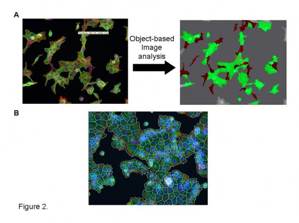 Figure 2 Bespoke image analysis solutions. A. Application of Definiens object based image analysis software to segment morphologically distinct cells from heterogenous cultures for quantitative analysis. Cells masked in red indicate significant pseudopod formation. B. Effective cell segmentation of challenging cell cultures utilizing cytoplasmic markers (cell mask –Invitrogen; phalliodin labelled F-actin -Sigma) and Definiens multiparametric image analysis algorithm