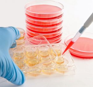 close up of person using a pipette to move cell cultures into agar plates - idea of cell line development