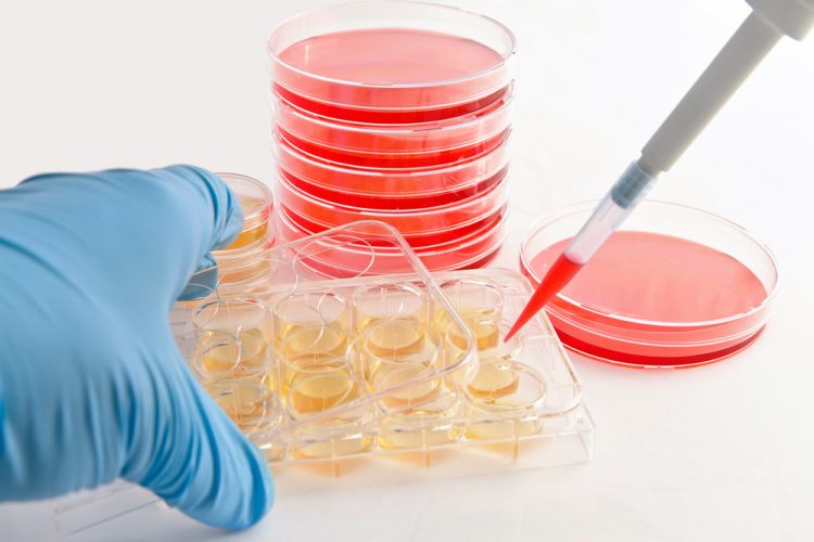 close up of person using a pipette to move cell cultures into agar plates - idea of cell line development