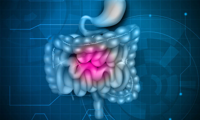 Crohn’s disease