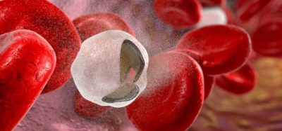 Therapeutic-first for cold agglutinin disease haemolytic anaemia