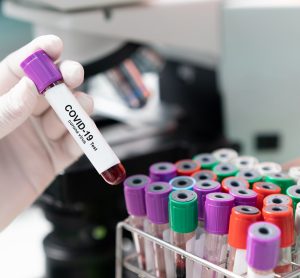 gloved hand holding a blood sample vial labelled 'COVID-19 test' next to a microscope