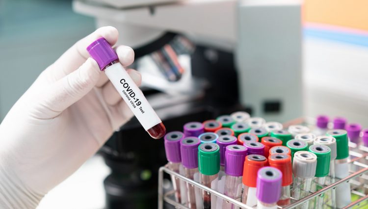 gloved hand holding a blood sample vial labelled 'COVID-19 test' next to a microscope