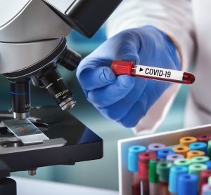 microscope next to scientist holding blood sample tube labelled COVID-19