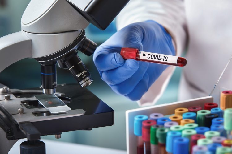 microscope next to scientist holding blood sample tube labelled COVID-19