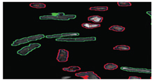 Figure 15: Showing screen shot of a mixed population of calcium tolerant (rod shaped bounded in green) and calcium intolerant primary adult cardiomyocytes (short and rounded bounded in red).