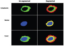 Figure 6: Illustrating a method of imaged based compartmentalisation of a single cell, which has been divided into two distinct spatial regions, (i) cytoplasmic (bounded by red line) and (ii) nuclear (bounded by yellow line). (Images supplied by Navin Verma Dept Clinical Medicine Trinity College Dublin)