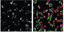 Figure 7: Images of lymphocytes segmented and selected=