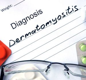 dermatomyositis