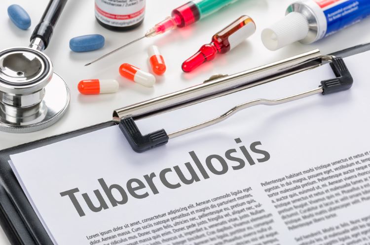 WHO updates guidelines for treating drug-resistant tuberculosis