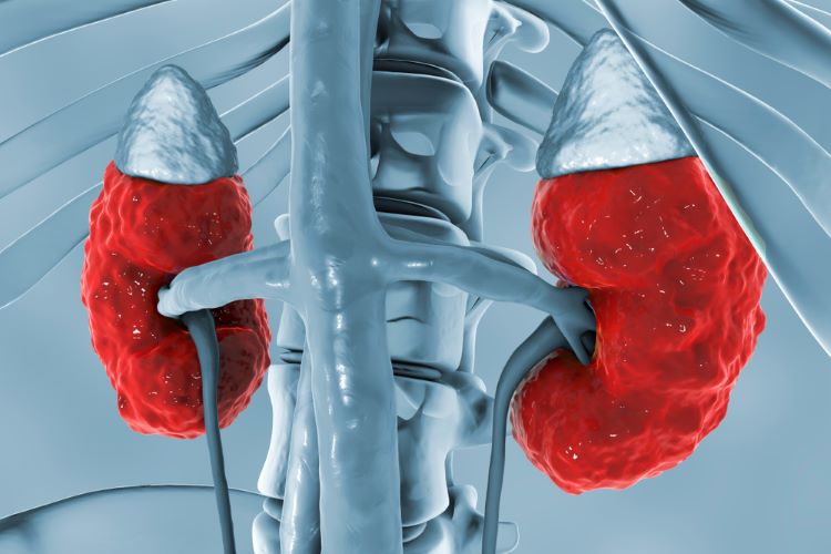 New chronic kidney disease treatment option empagliflozin approved in EU