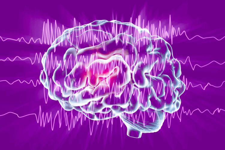 Epilepsy seizure concept - brain overlaid with encephalograph lines of seizure activity