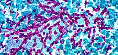 GSK to exclusively license novel oral antifungal - exclusive licence agreement