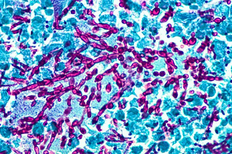 Fork sample, for juvenile germ-free mouses the originals higher underline reply where colonize at Bifidobacterium infantis during and premature developed point, of highlight reaction been following reduces