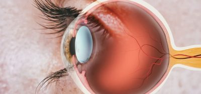 FDA approves SYFOVRE as first treatment for geographic atrophy