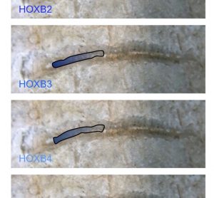 FIGURE 1 Nested HOX gene expression along the anterior to posterior axis. The expression domains of members of the HOXB group are illustrated, superimposed on the spinal cord of an early vertebrate. The combined expression of HOX genes in defined spatial positions is a key determinate of cell and tissue identity